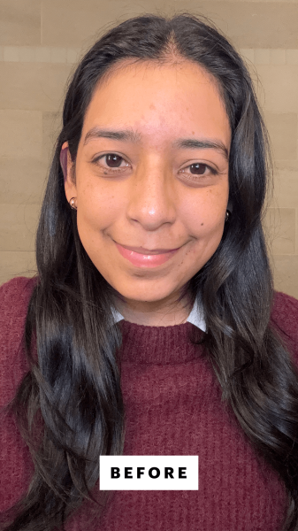 Foresto before applying the Round Lab 1025 Dokdo Toner