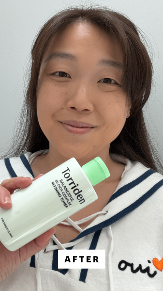 Lee after applying the Torriden Balanceful 5D Cica Complex AHA Pore Refining Toner